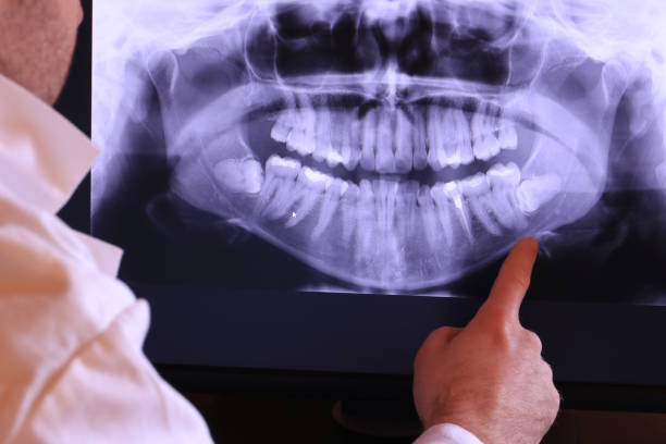 Best Broken Tooth Emergency  in Haliimaile, HI